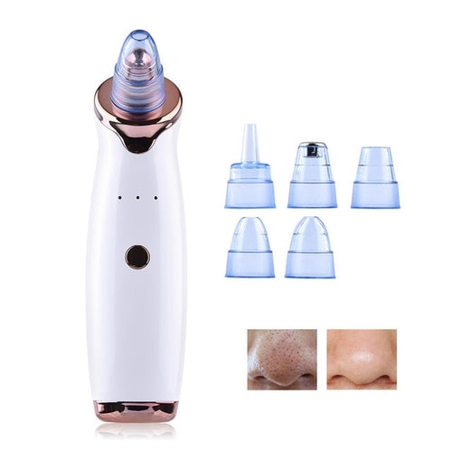 Load image into Gallery viewer, Blackhead Remover Face Deep Pore Cleaner Acne
